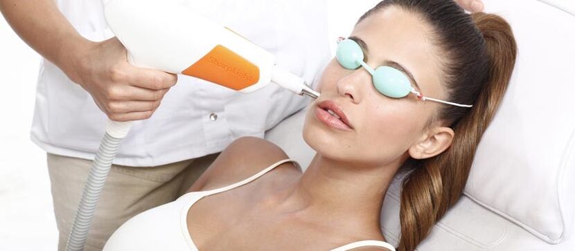 Laserový resurfacing kůže